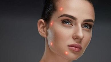 Na czym polega frakcyjne odmładzanie skóry